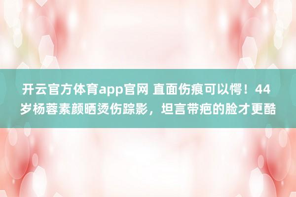 开云官方体育app官网 直面伤痕可以愕！44 岁杨蓉素颜晒烫伤踪影，坦言带疤的脸才更酷